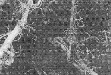 микрофотография пульпы Кевлара